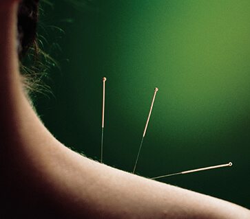 Acupuncture Treatments in Wyomissing, PA